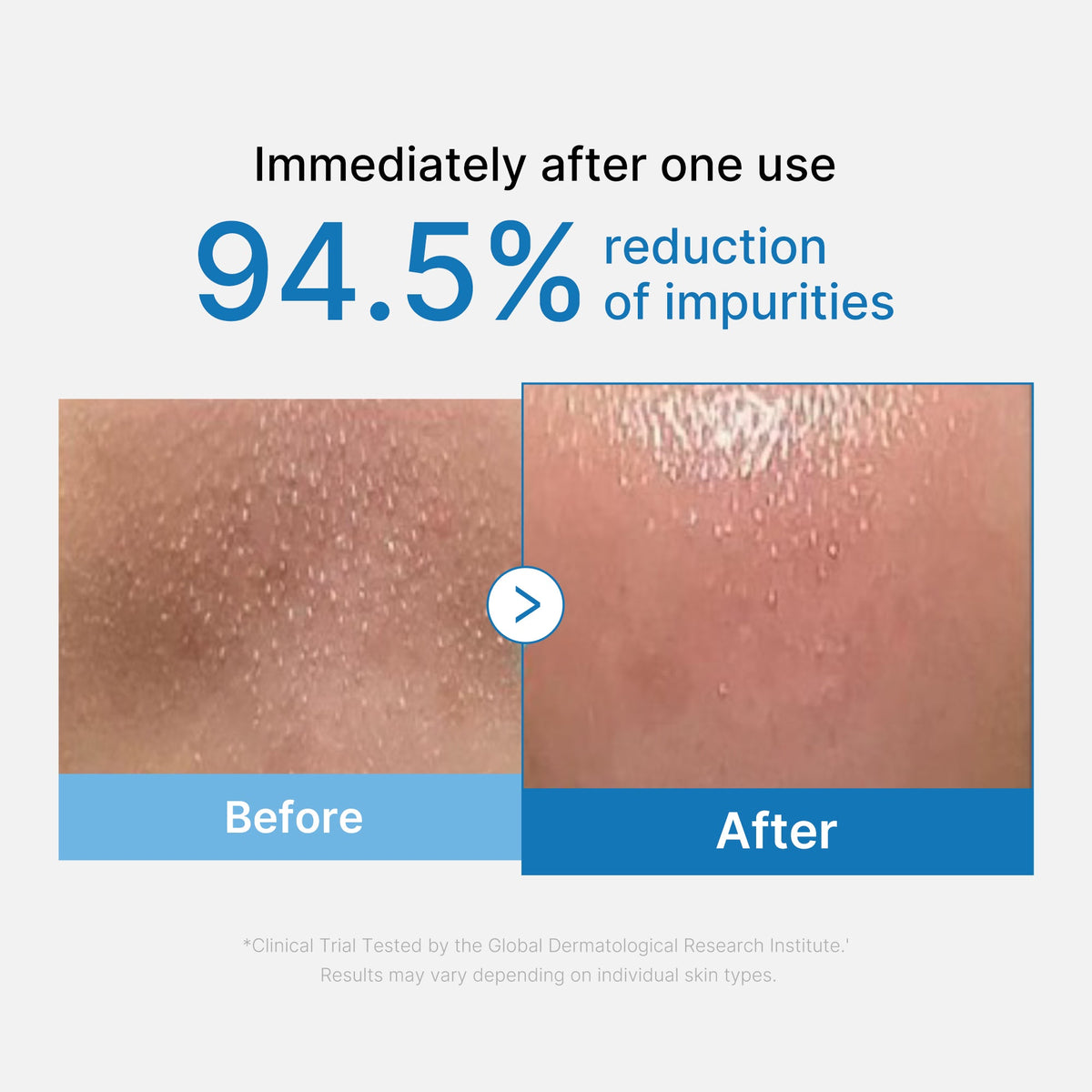 zero-pore-blackhead-deep-cleansing-oil-k1 01_eed557ec-5857-46a2-8b17-dbd67c692dcb.jpg