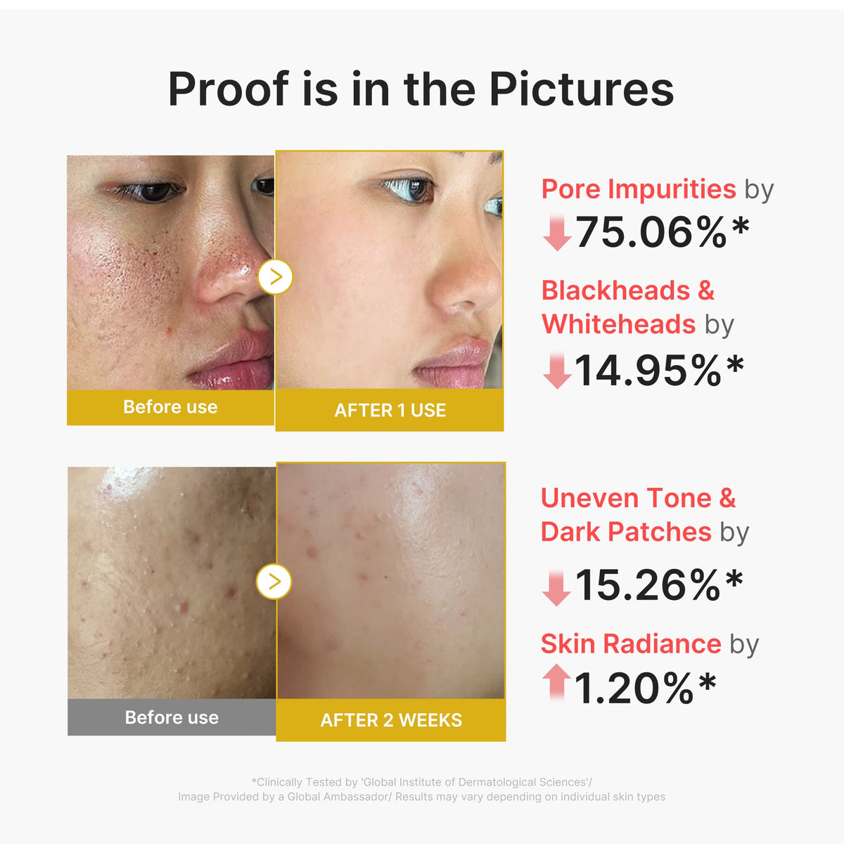 kojic-acid-turmeric-peel-shot-m3 02_45fe66d3-b3f6-4100-aa52-2afd7eded417.jpg
