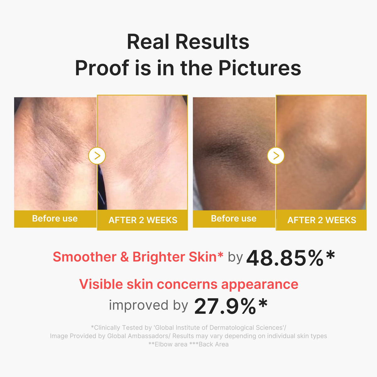 kojic-acid-turmeric-body-peel-shot-s4 02_72880cfc-382b-440b-8152-7e3dce87da2a.jpg