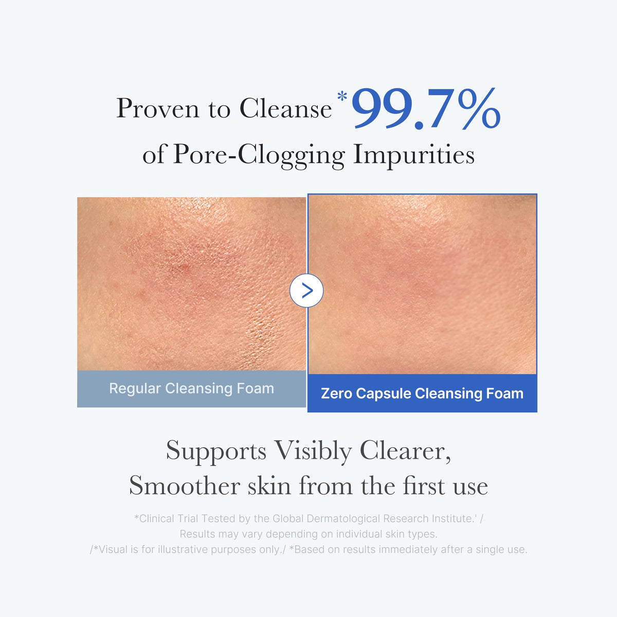 zero-pore-capsule-cleansing-foam-f0 02_c1fb9dfb-86c5-4038-8ff8-490d1006276c.jpg