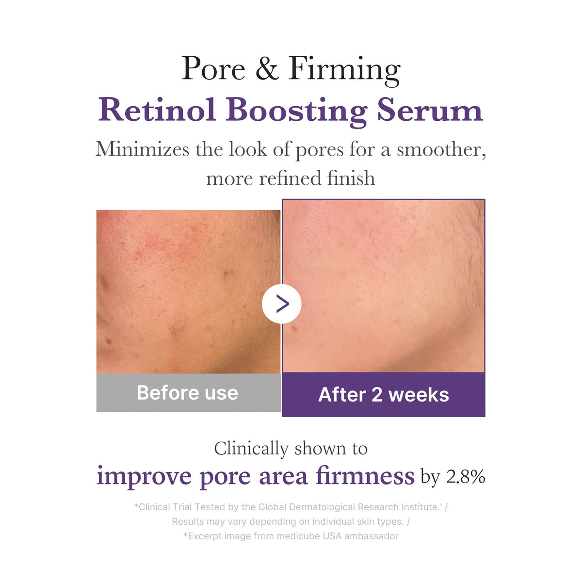 retinol-nmn-boosting-serum-s0 03_3510e7a5-5633-4a18-81ea-1389593bd517.jpg