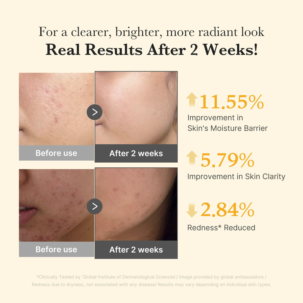 kojic-acid-turmeric-capsule-serum-s2 03_436487f5-76df-490e-8a61-01118373efbd.jpg