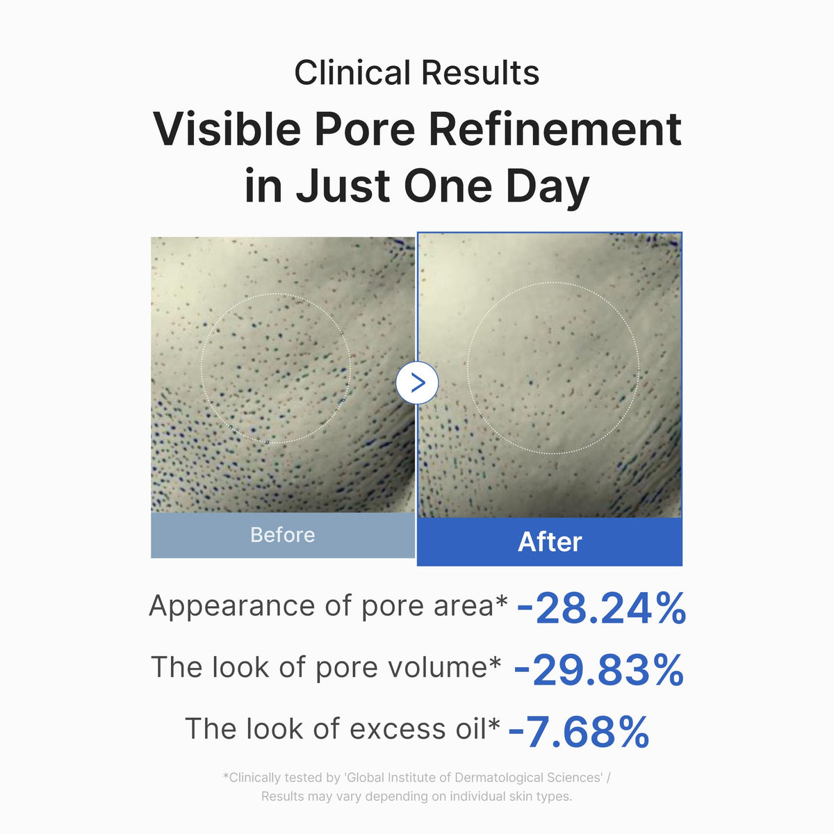 zero-pore-one-day-peptide-serum-q2 03_448eab9e-dc60-4dcb-9e4e-e863aabb61b0.jpg