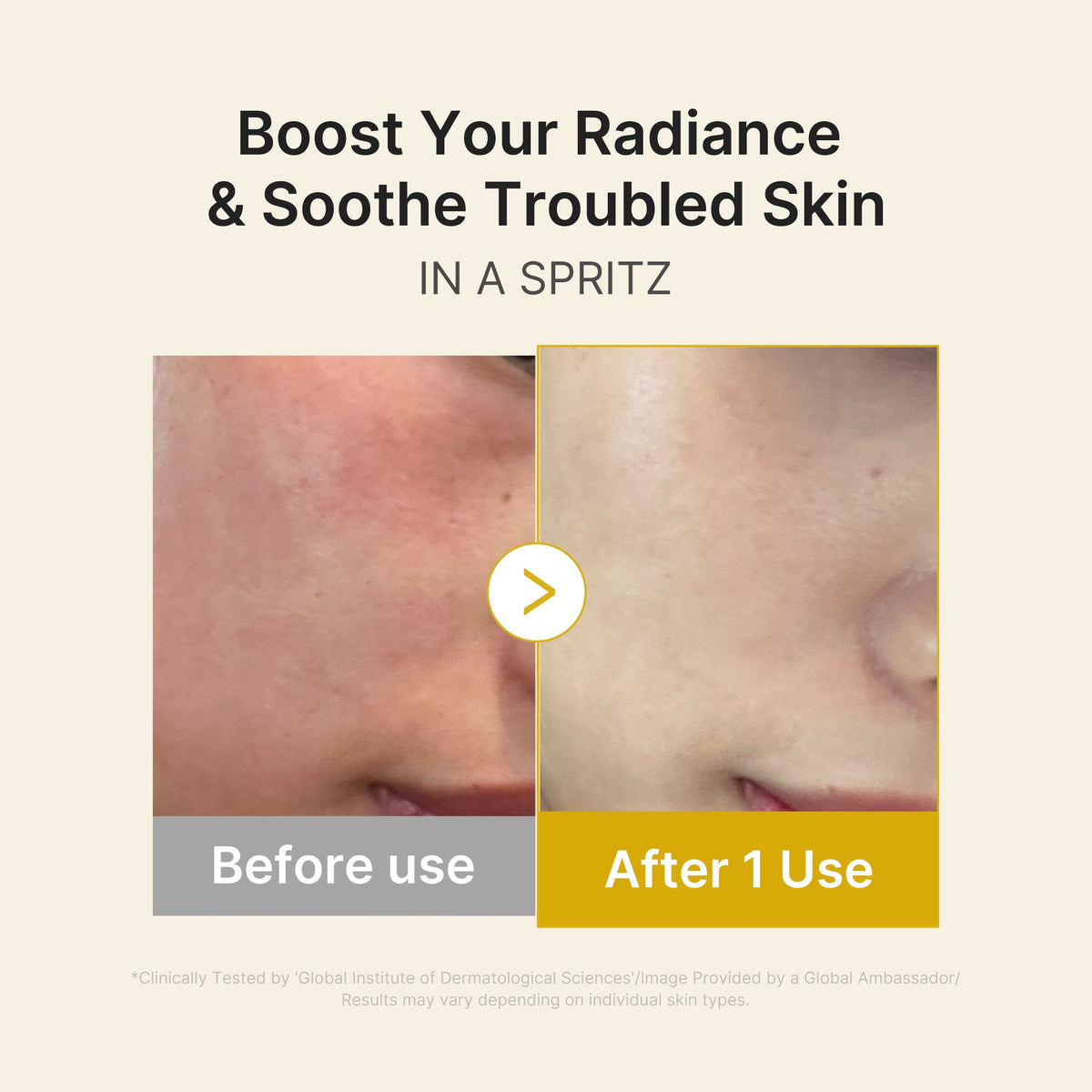 kojic-acid-turmeric-vitamin-gold-jelly-mist-serum-h0 03_dc9cd19e-4e57-49d3-9b66-c7762e8a63f1.jpg