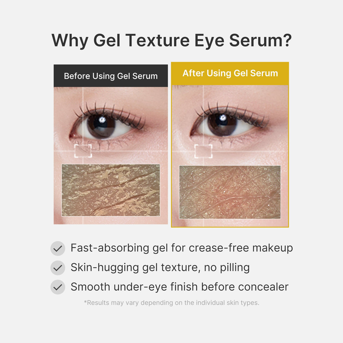 kojic-acid-tumeric-eye-gel-serum-v3 04_0487ef36-49f4-4294-8049-bb55118b05fe.jpg