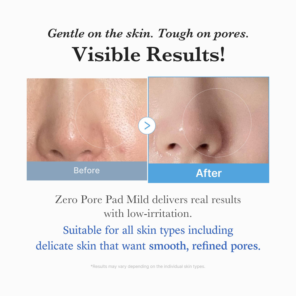 zero-pore-madecassoside-pads-mild-x1 04_6357f9f9-483b-4891-82c6-a58d336e62c8.jpg
