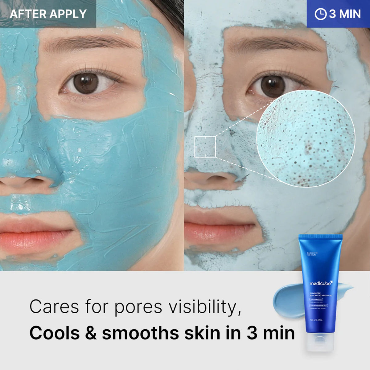zero-pore-blackhead-mud-mask-k5 04_867c0459-a94e-40d3-bd9a-70400edabe8d.jpg