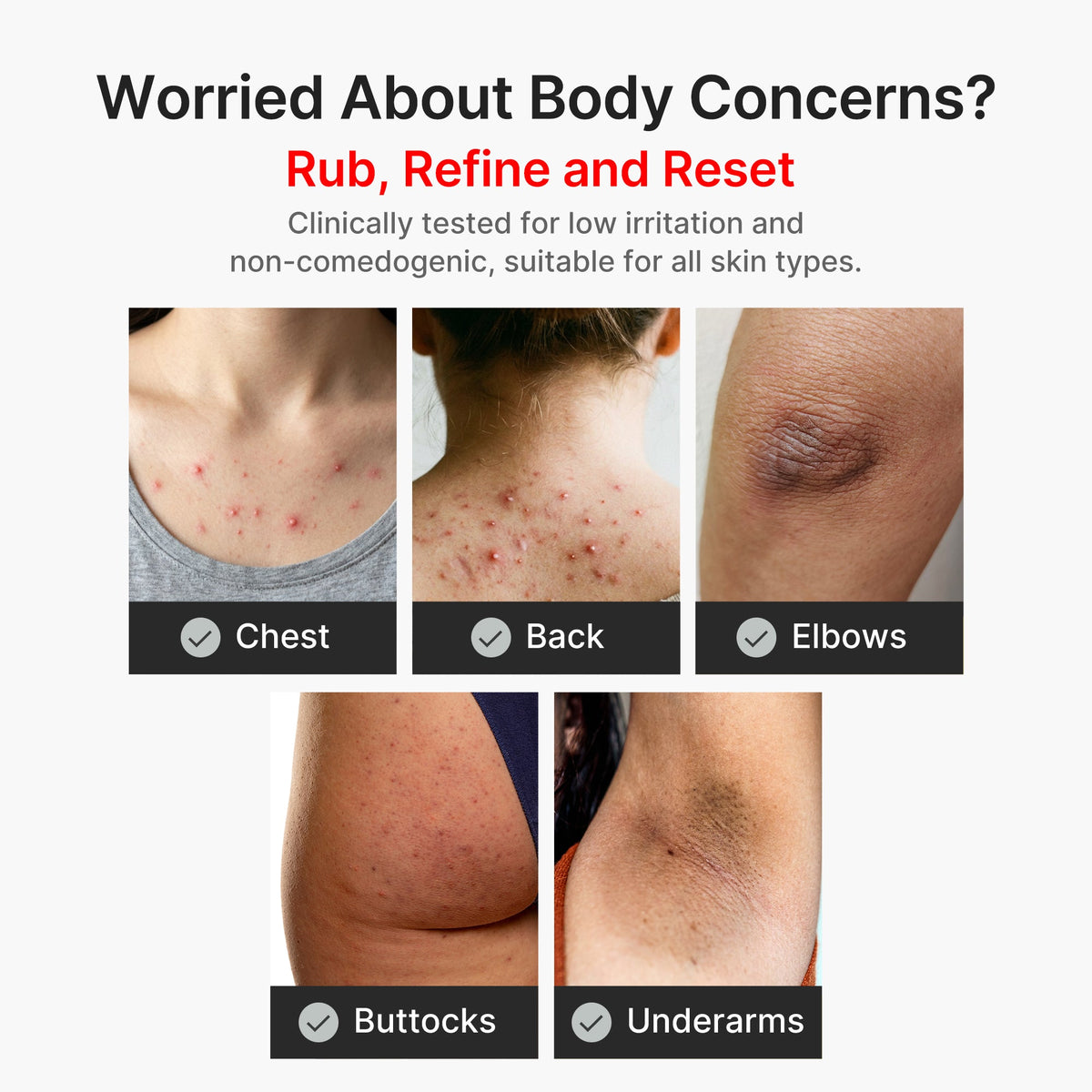 kojic-acid-turmeric-body-peel-shot-s4 04_8a7237f2-3ebf-401e-bd85-54841aeb3efc.jpg