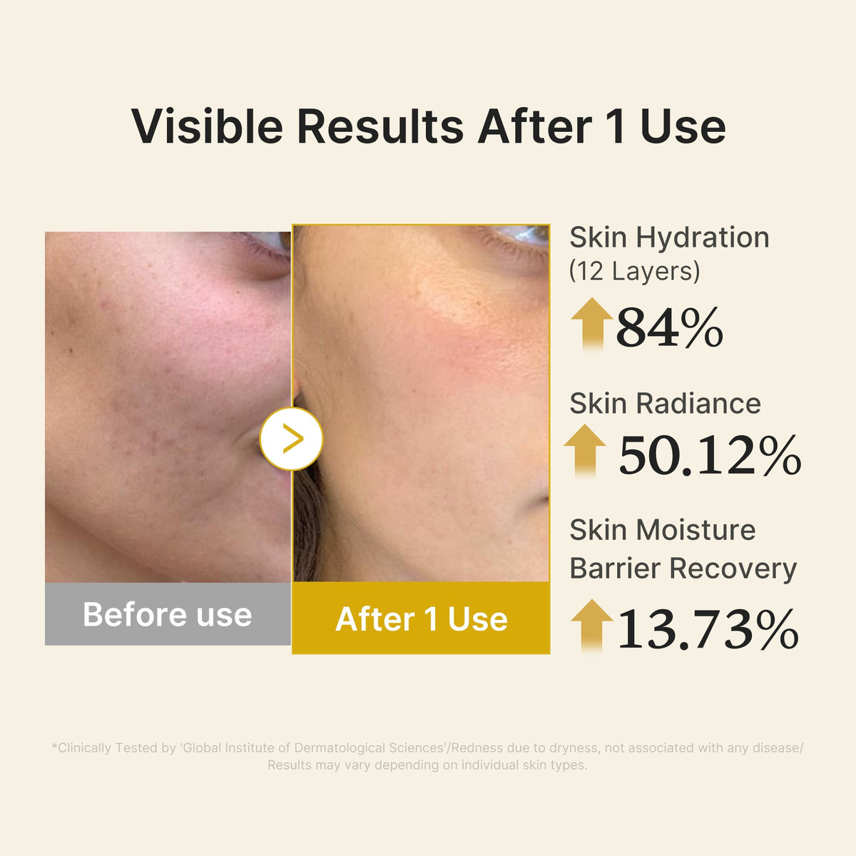kojic-acid-turmeric-vitamin-gold-jelly-mist-serum-h0 04_d5c55ef1-e03b-494d-bc0d-a1ecc7fc2abf.jpg