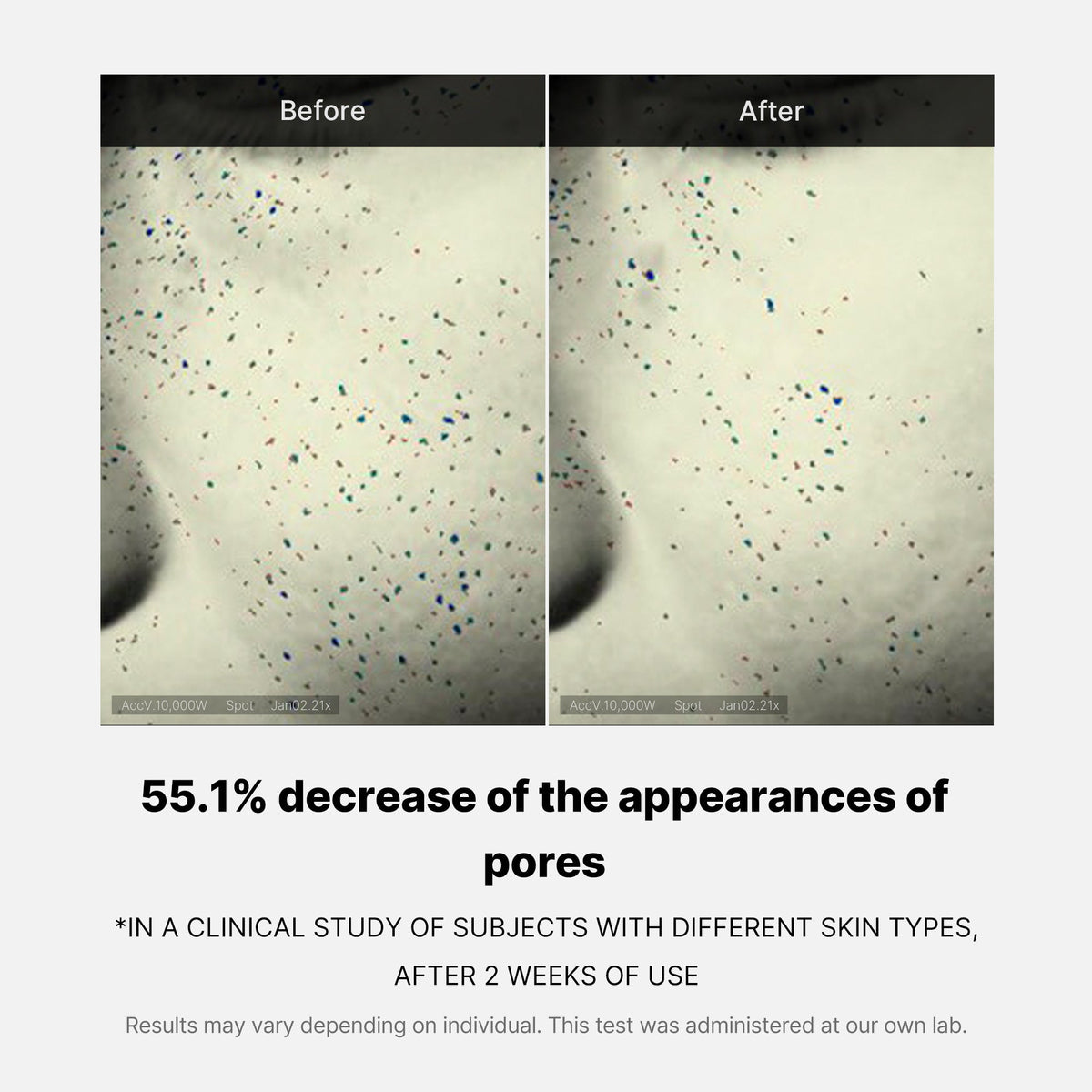pore-care-duo-v6 05_12ddab8a-64be-4612-8ee1-27e5ec701921.jpg
