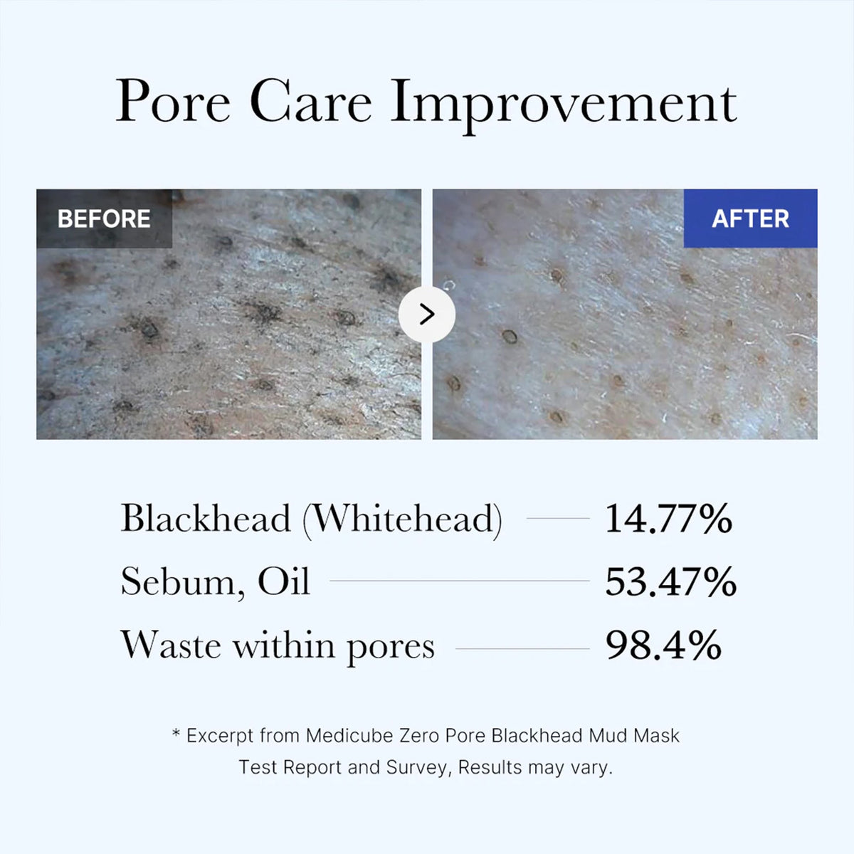 zero-pore-blackhead-mud-mask-k5 05_9362a158-c2b3-4525-acc0-631a2cfdea47.jpg