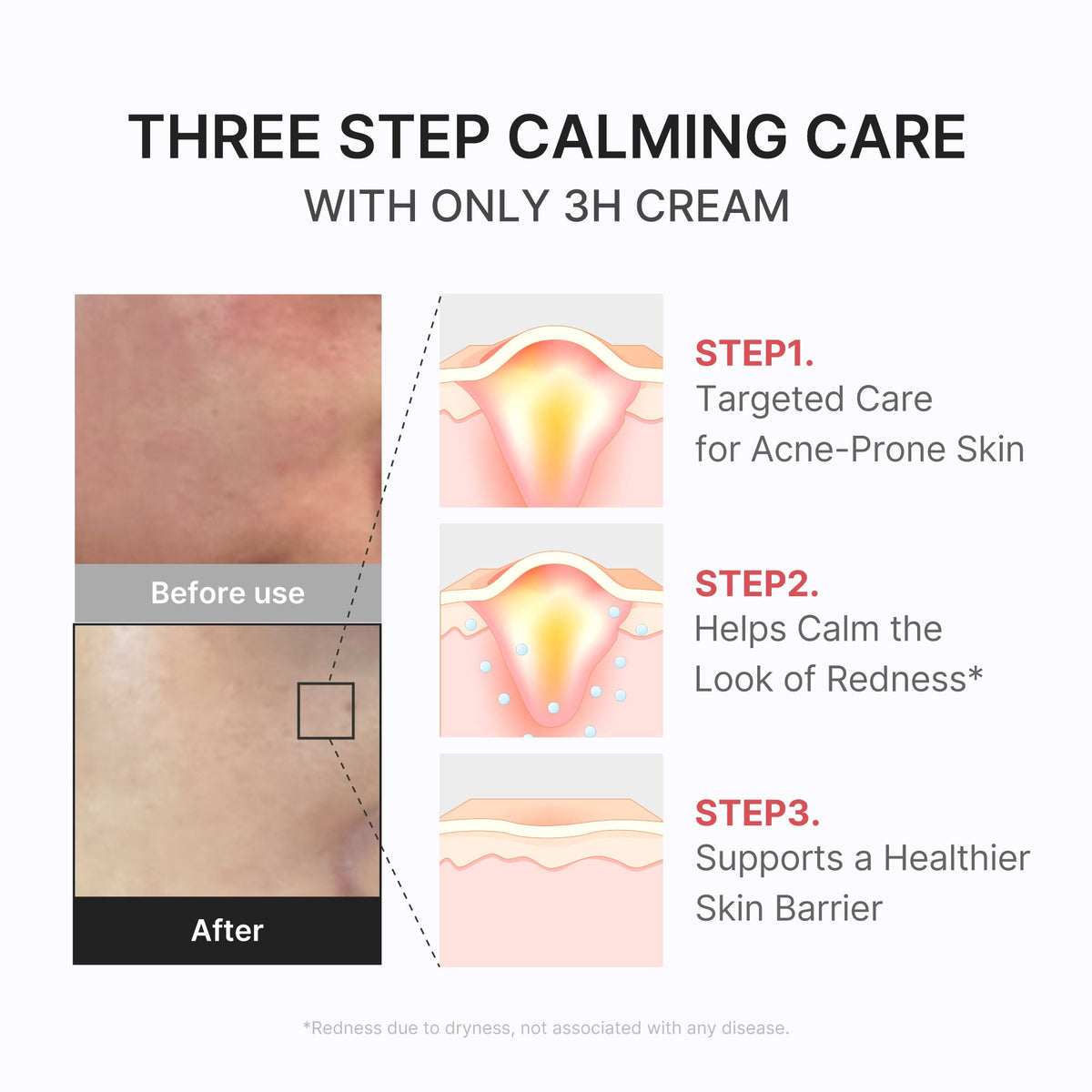 3h-daily-relief-cream-d6 3H_04.jpg