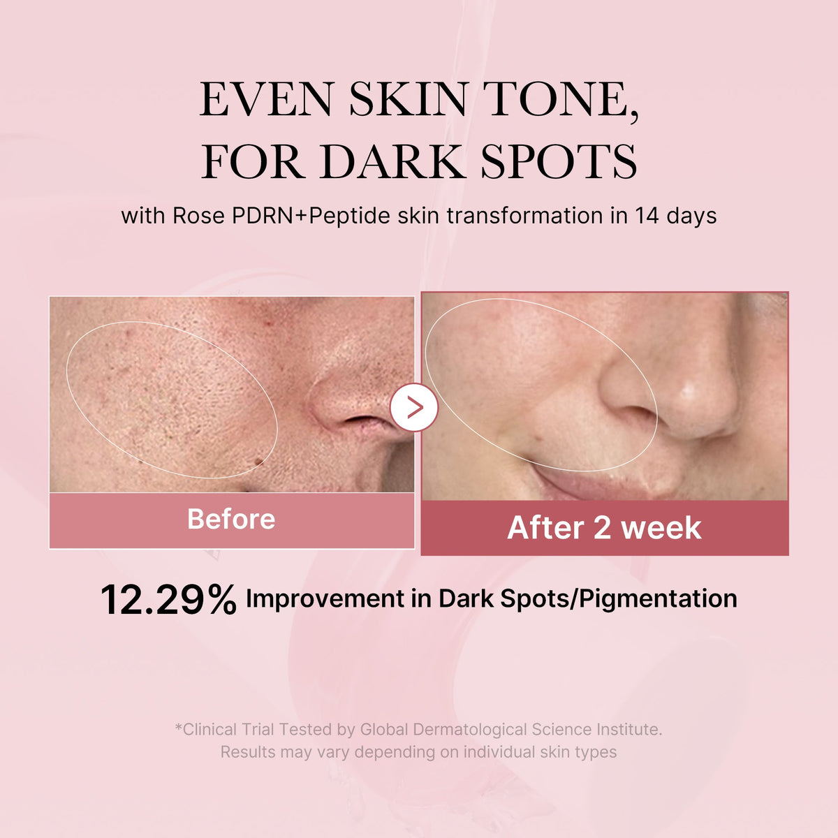 pdrn-pink-peptide-toner-h3 PDRN_01_308c518e-5ac6-4e54-99bd-eabc8796739b.jpg