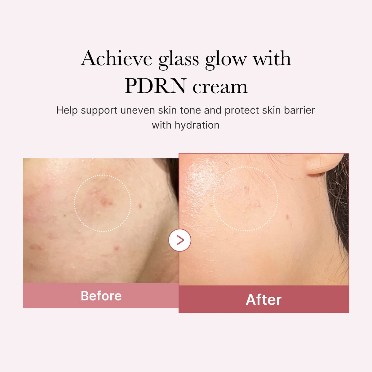 pdrn-pink-peptide-cream-y7 PDRN_02_d7805bfe-cf43-446a-b71b-a276683f136b.jpg