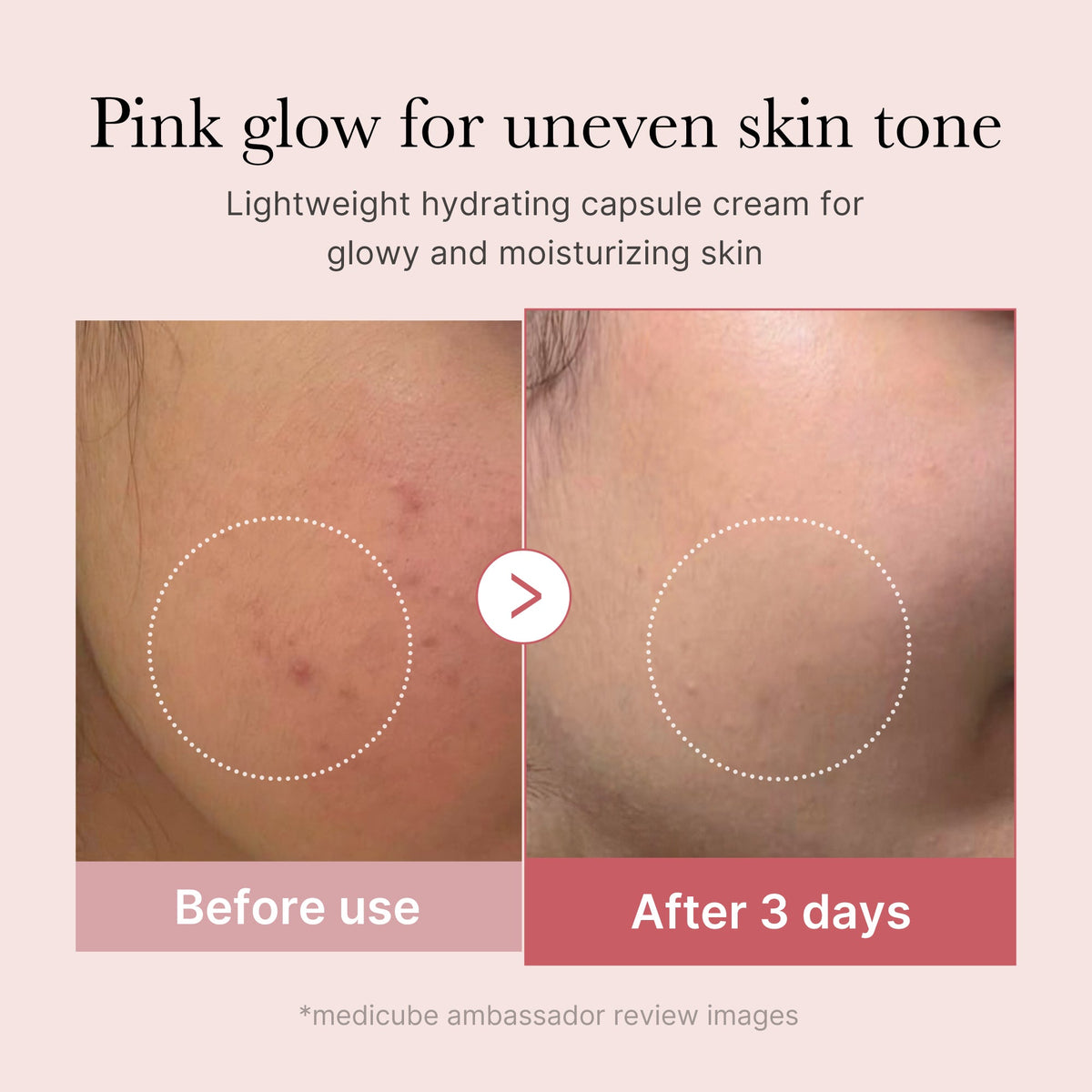 pdrn-pink-collagen-capsule-cream-a3 PDRN_03_058d09d8-4f44-4b1e-927c-e27b1738ae51.jpg