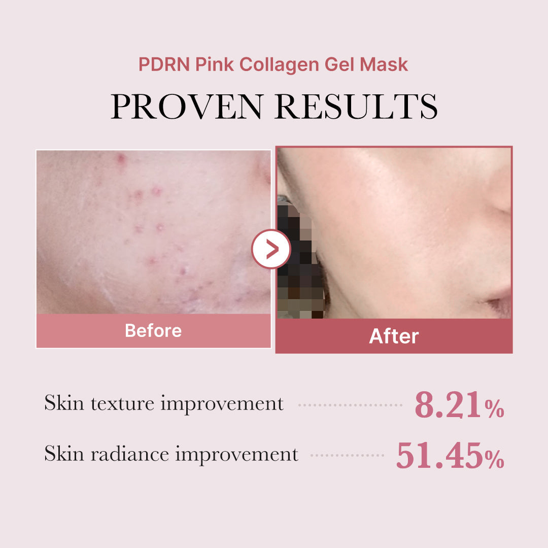 salmon-pdrn-pink-collagen-jelly-gel-mask-l5 PDRN_12.jpg